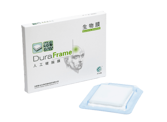Substituto Dural Duraframe – Tech Tinkful
